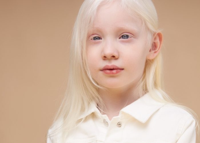 Sık görülen ama  ‘nadir’ olduğu bilinmeyen 3 hastalık!