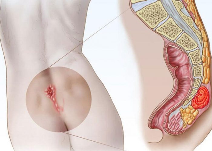 Çocuklarda kıl dönmesinin nedenleri